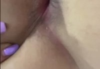 Showed anal hole close up