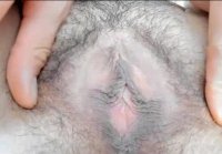 hairy mature